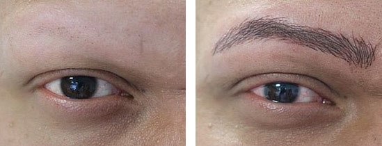 Dermopigmentation des sourcils