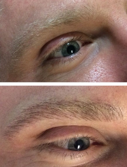 Dermopigmentation des sourcils